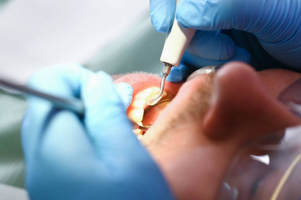 Best Emergency Cosmetic Dentistry (e.g., broken veneers) in Heritage Lake, IL