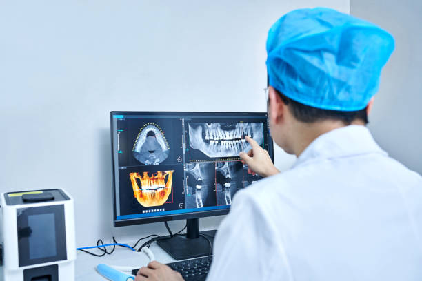Best Knocked-Out Tooth (Avulsed Tooth) Treatment in Heritage Lake, IL